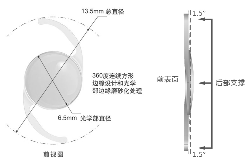 Proming普諾明大光學區(qū)高次非球面人工晶狀體ALD